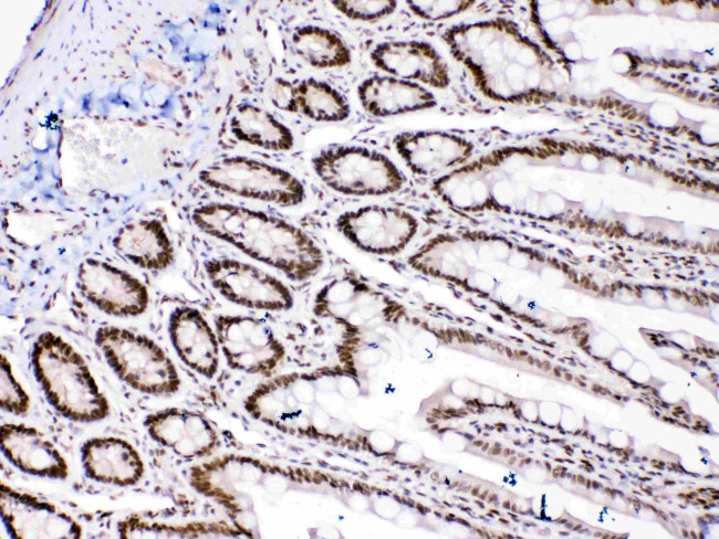 HMGB1 Antibody in Immunohistochemistry (Paraffin) (IHC (P))