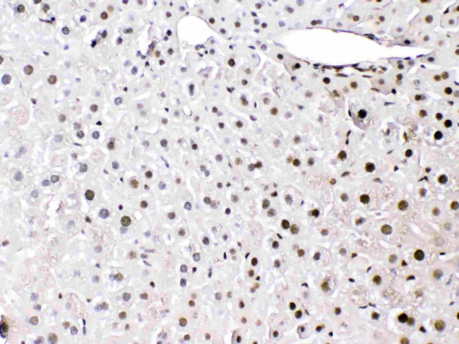 HMGB1 Antibody in Immunohistochemistry (Paraffin) (IHC (P))