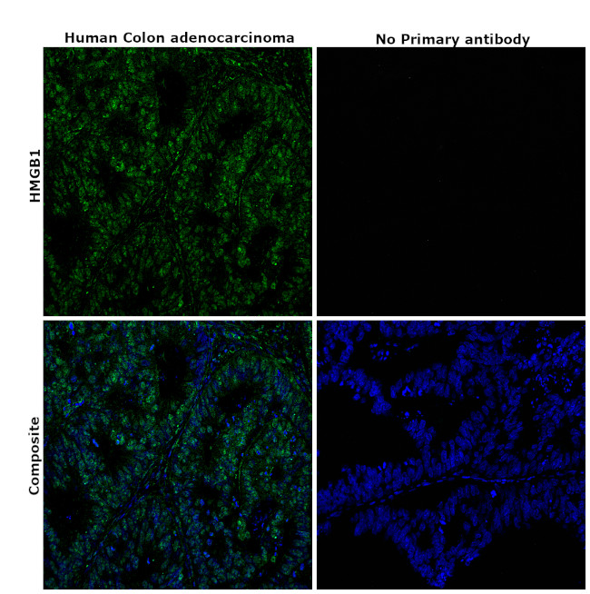 HMGB1 Antibody in Immunohistochemistry (Paraffin) (IHC (P))