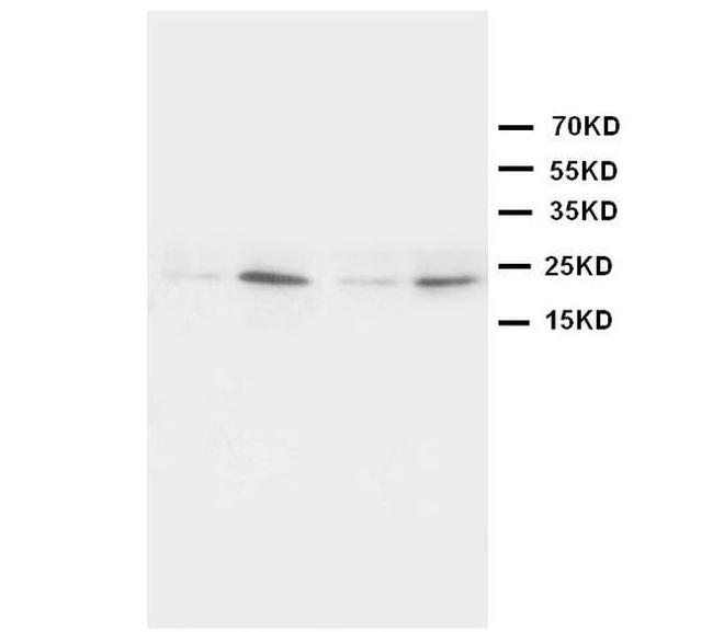 HMGB4 Antibody in Western Blot (WB)