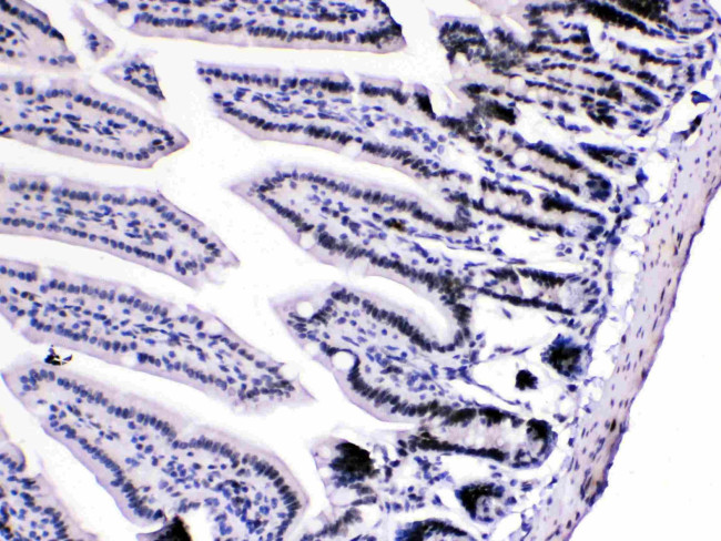 hnRNP A1 Antibody in Immunohistochemistry (Paraffin) (IHC (P))