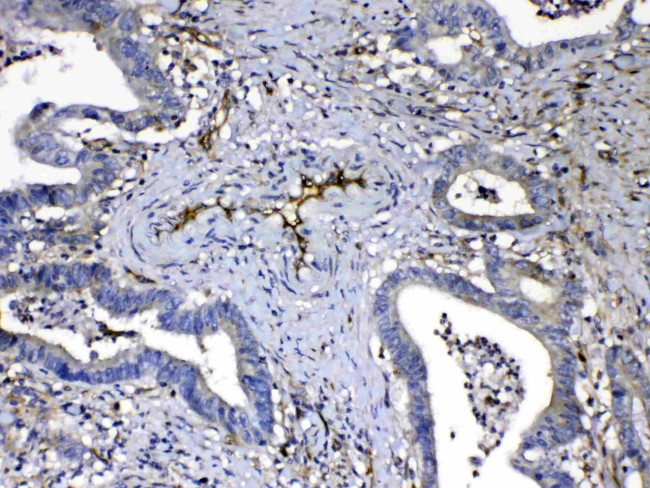 HOMER3 Antibody in Immunohistochemistry (Paraffin) (IHC (P))