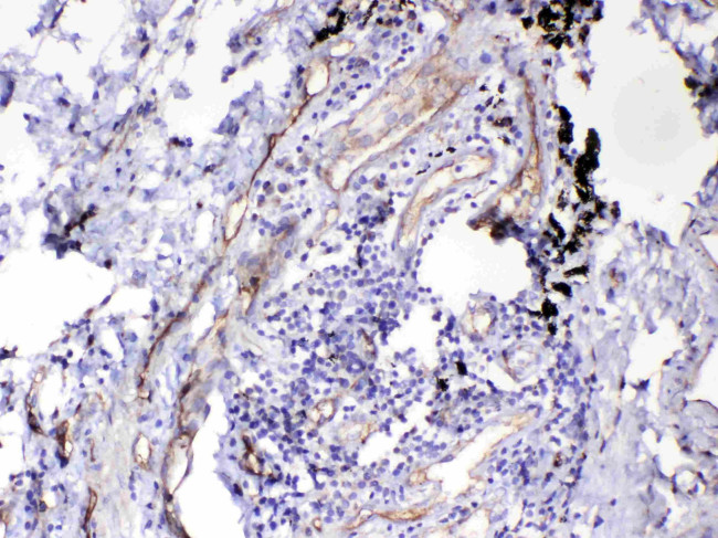 HOMER3 Antibody in Immunohistochemistry (Paraffin) (IHC (P))