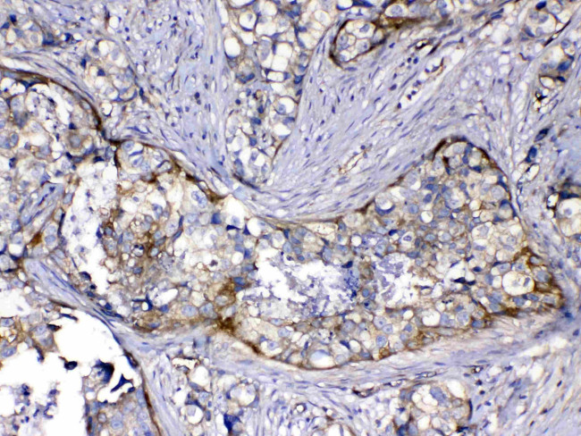 HOMER3 Antibody in Immunohistochemistry (Paraffin) (IHC (P))