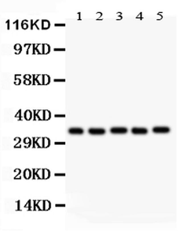 HOXA11 Antibody in Western Blot (WB)