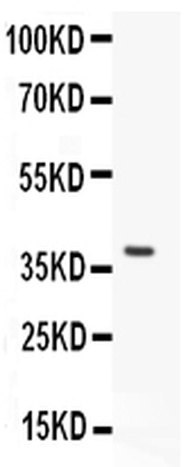 HOXA11 Antibody in Western Blot (WB)