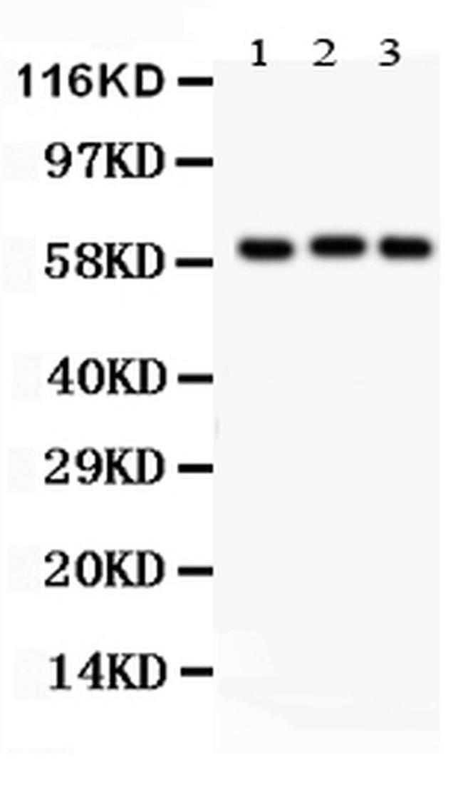 HPa1 Antibody in Western Blot (WB)