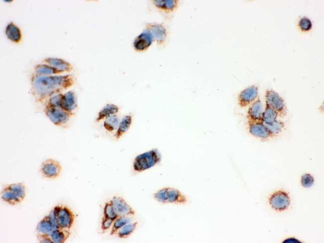 ERAB Antibody in Immunocytochemistry (ICC/IF)