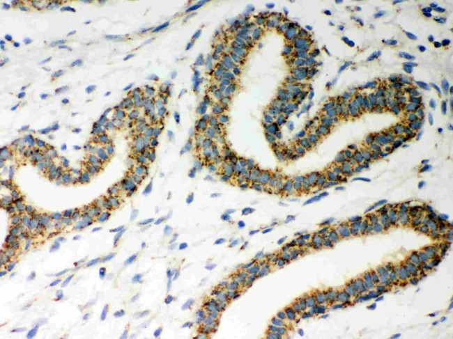 ERAB Antibody in Immunohistochemistry (Paraffin) (IHC (P))