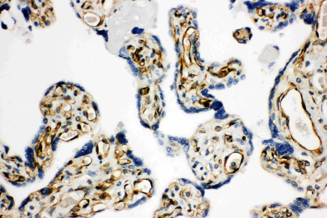 HSD17B2 Antibody in Immunohistochemistry (Paraffin) (IHC (P))