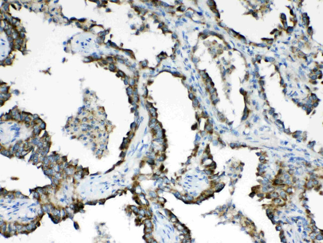 HSD17B4 Antibody in Immunohistochemistry (Paraffin) (IHC (P))