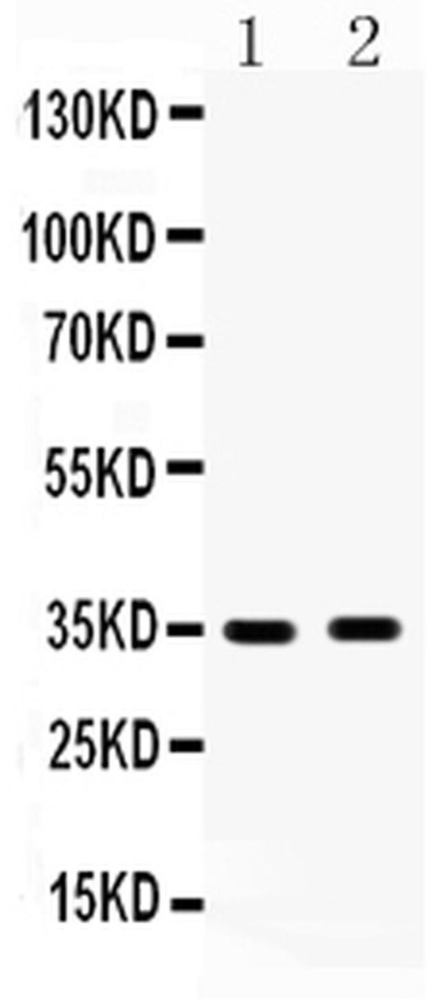 HSD17B6 Antibody in Western Blot (WB)