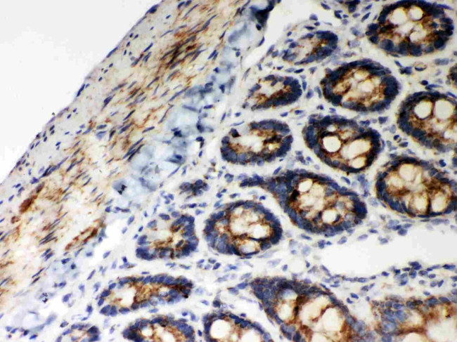 HSP60 Antibody in Immunohistochemistry (Paraffin) (IHC (P))