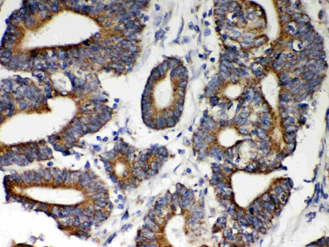 HSP60 Antibody in Immunohistochemistry (Paraffin) (IHC (P))