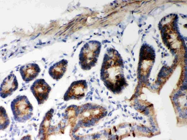 HSP60 Antibody in Immunohistochemistry (Paraffin) (IHC (P))