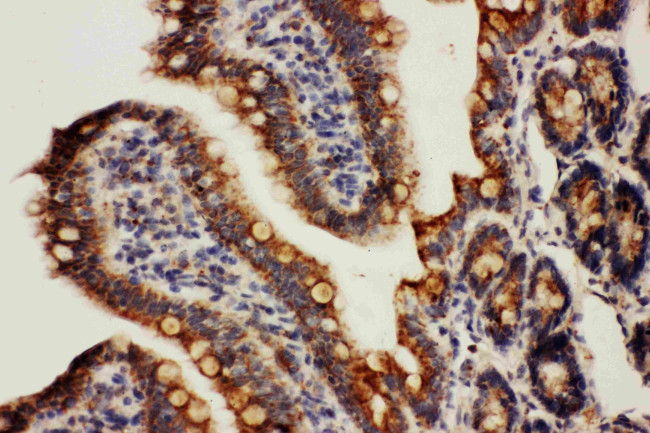 HSPE1 Antibody in Immunohistochemistry (Paraffin) (IHC (P))