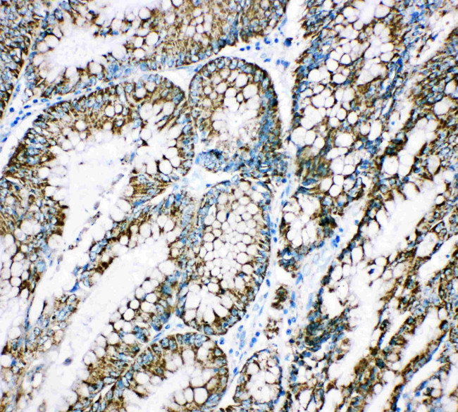 HSPE1 Antibody in Immunohistochemistry (Paraffin) (IHC (P))