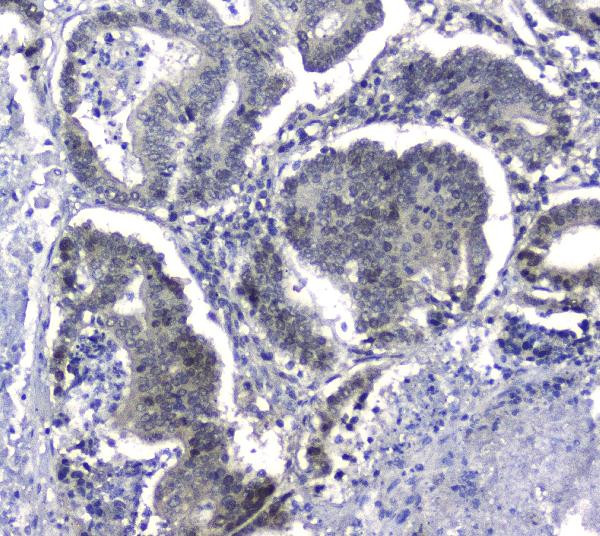 HSP105 Antibody in Immunohistochemistry (Paraffin) (IHC (P))