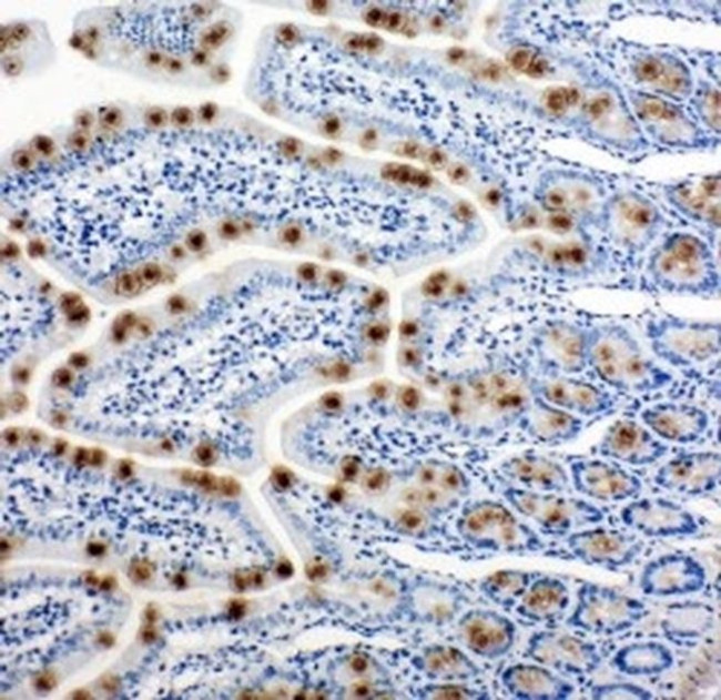 HSP105 Antibody in Immunohistochemistry (Paraffin) (IHC (P))