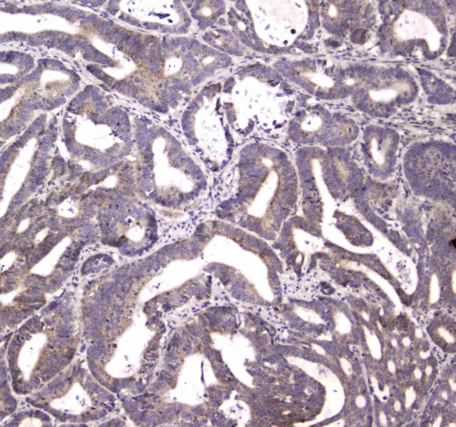 HTRA1 Antibody in Immunohistochemistry (Paraffin) (IHC (P))