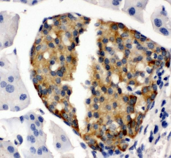 Bone SialoProtein Antibody in Immunohistochemistry (Paraffin) (IHC (P))