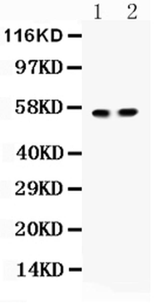 ICA1 Antibody in Western Blot (WB)