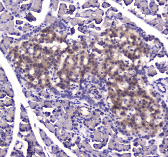 IDE Antibody in Immunohistochemistry (Paraffin) (IHC (P))