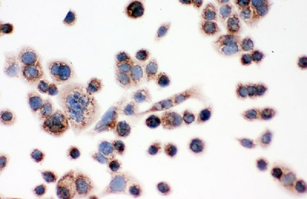 IDH2 Antibody in Immunocytochemistry (ICC/IF)