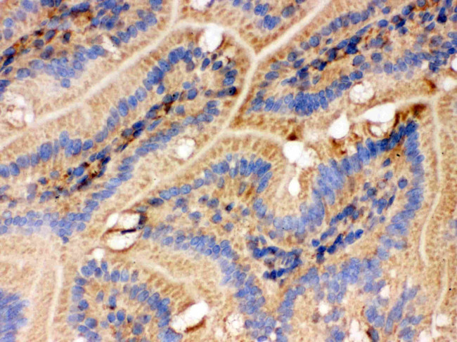 IDH2 Antibody in Immunohistochemistry (IHC)