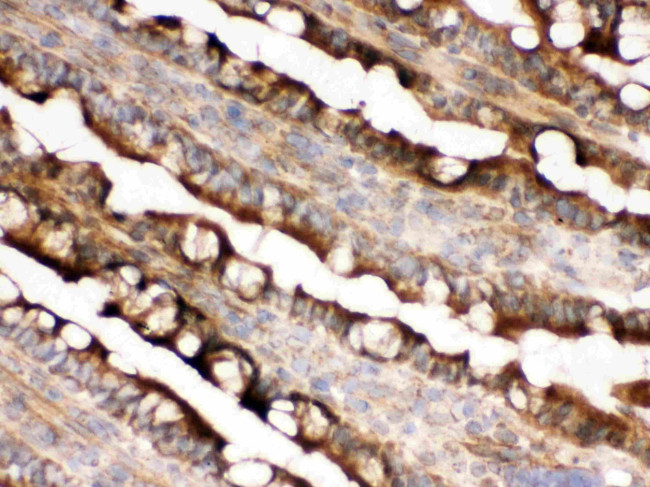 IDH2 Antibody in Immunohistochemistry (IHC)