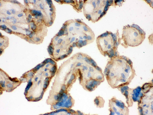 IDH2 Antibody in Immunohistochemistry (IHC)