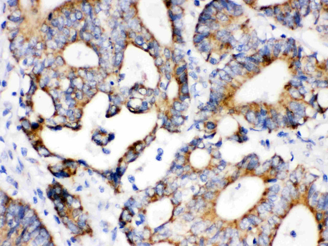 IDH2 Antibody in Immunohistochemistry (Paraffin) (IHC (P))