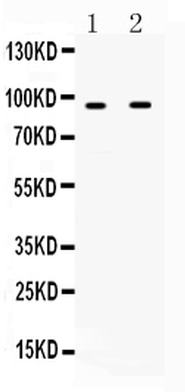 IFNGR1 (CD119) Antibody in Western Blot (WB)