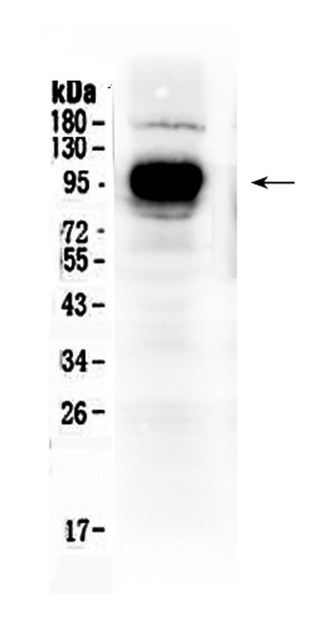 IFNGR1 (CD119) Antibody in Western Blot (WB)