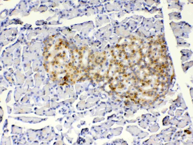 IGFBP-1 Antibody in Immunohistochemistry (Paraffin) (IHC (P))