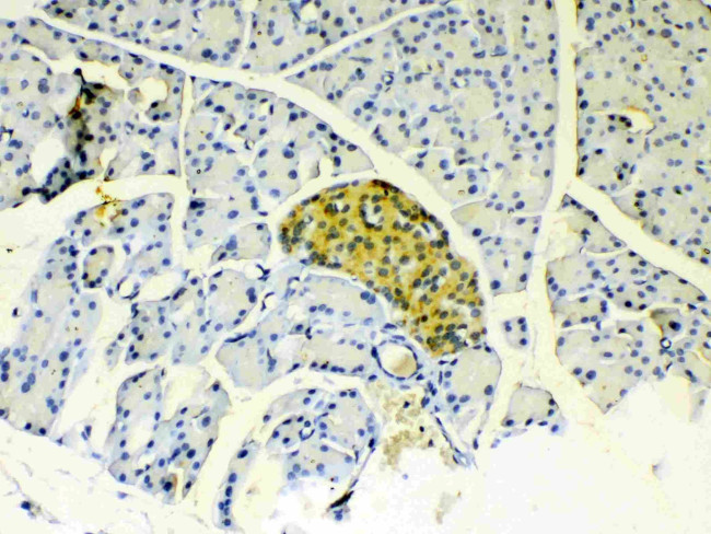 IGFBP-1 Antibody in Immunohistochemistry (Paraffin) (IHC (P))