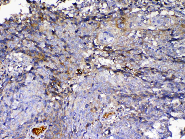 IGFBP2 Antibody in Immunohistochemistry (Paraffin) (IHC (P))