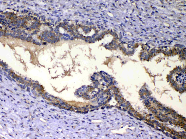 IGFBP2 Antibody in Immunohistochemistry (Paraffin) (IHC (P))