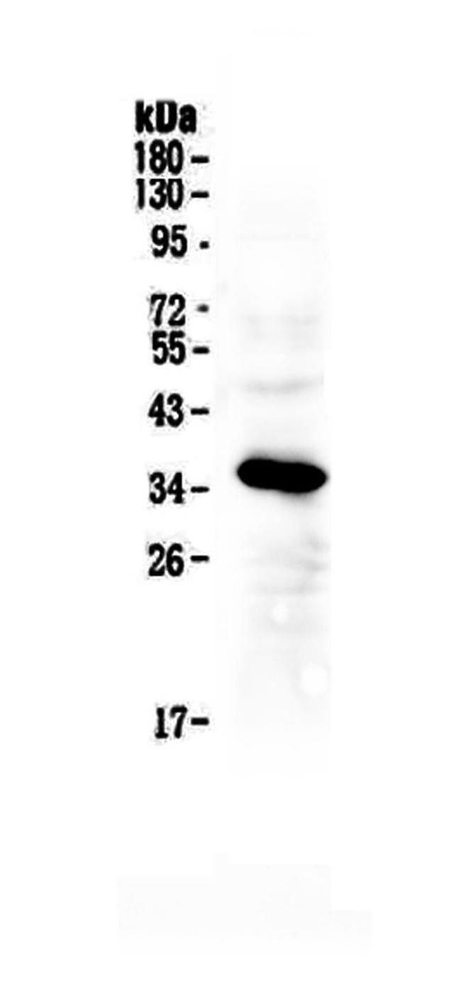 IGFBP2 Antibody in Western Blot (WB)