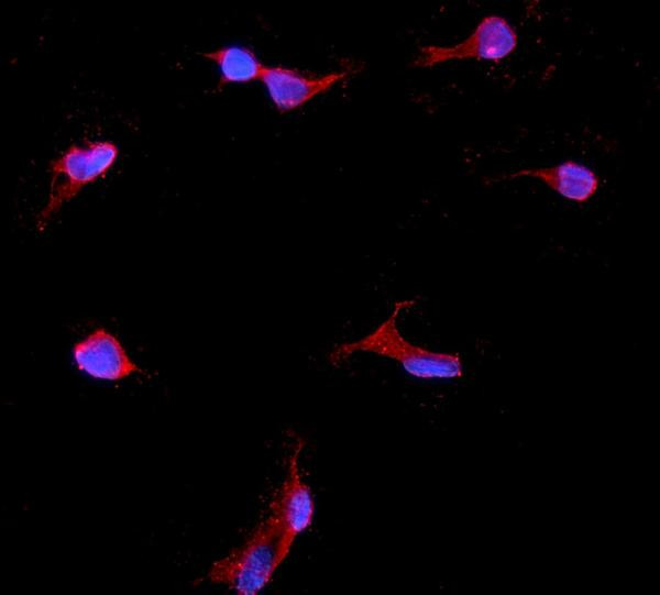 IGFBP2 Antibody in Immunocytochemistry (ICC/IF)