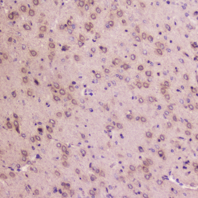 IGFBP2 Antibody in Immunohistochemistry (Paraffin) (IHC (P))