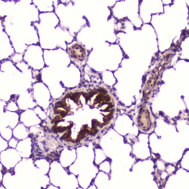 IGFBP2 Antibody in Immunohistochemistry (Paraffin) (IHC (P))