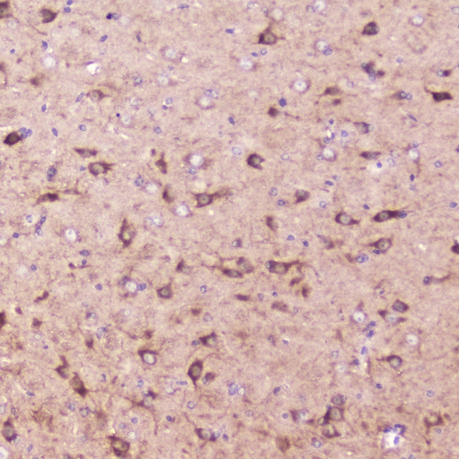 IGFBP2 Antibody in Immunohistochemistry (Paraffin) (IHC (P))