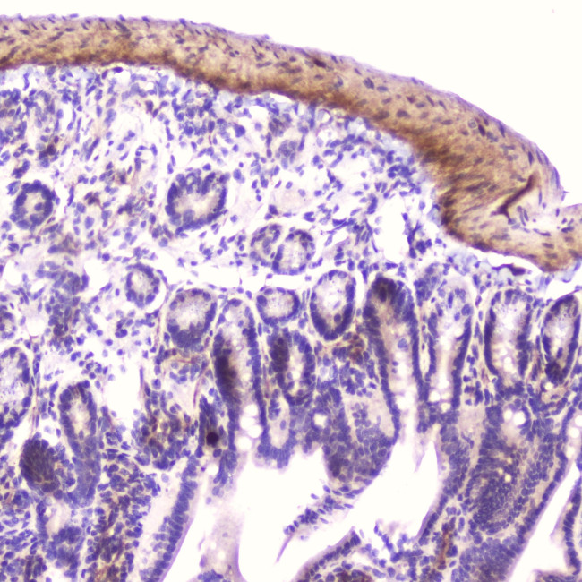 IGFBP2 Antibody in Immunohistochemistry (Paraffin) (IHC (P))