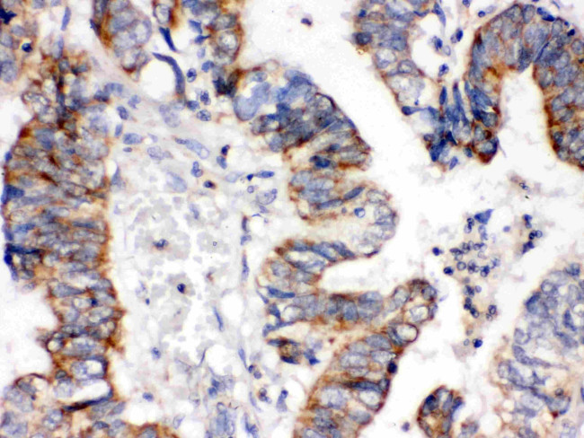 IGFBP3 Antibody in Immunohistochemistry (Paraffin) (IHC (P))