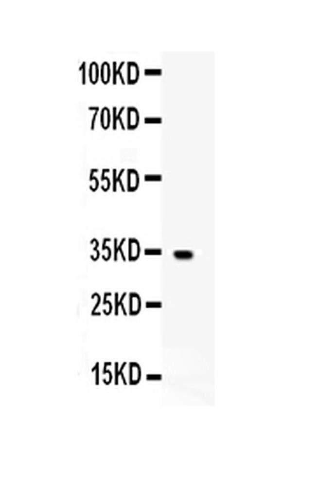 IGFBP5 Antibody in Western Blot (WB)