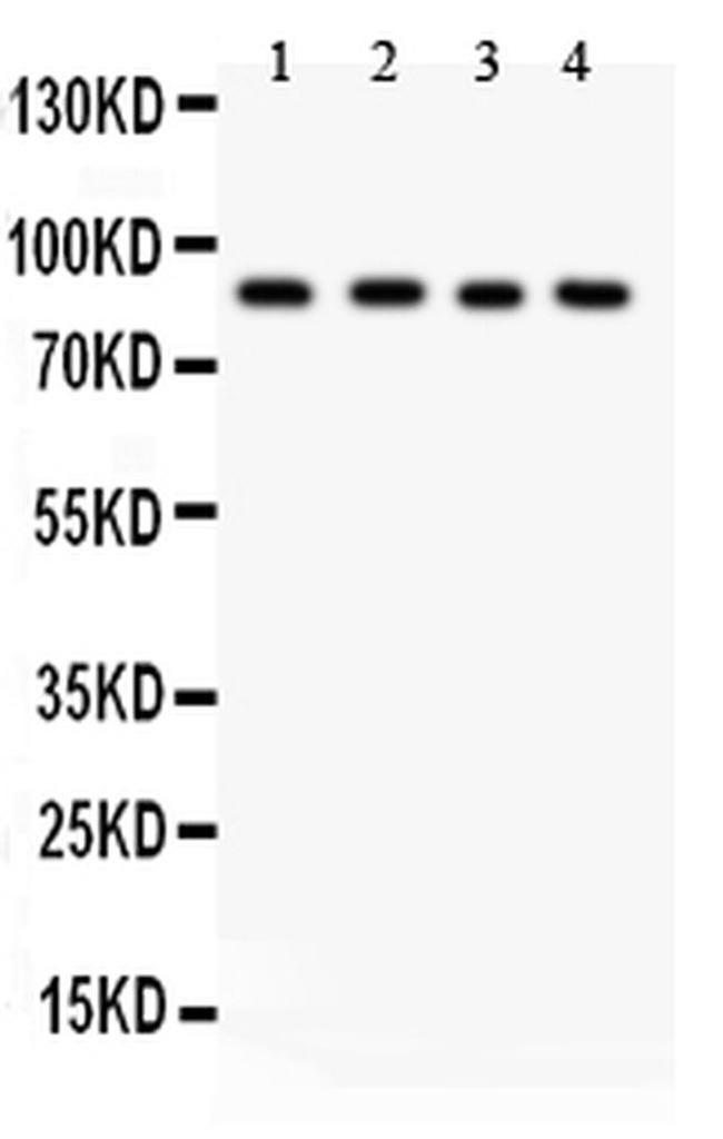 IKK beta Antibody in Western Blot (WB)