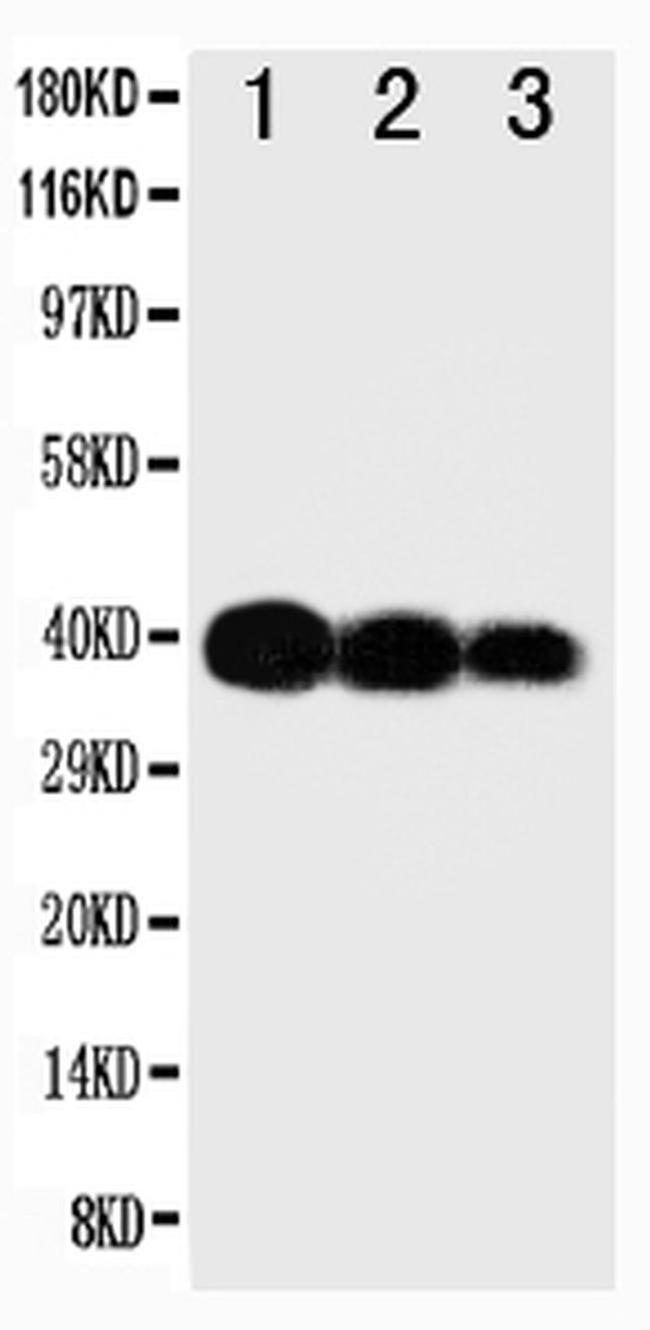 IL-12 p40 Antibody in Western Blot (WB)