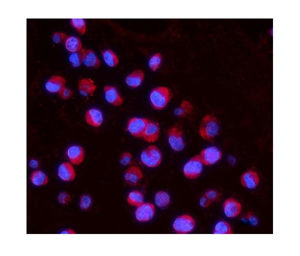 IL15RA Antibody in Immunocytochemistry (ICC/IF)