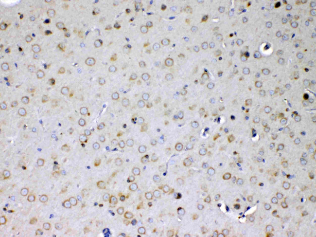 IL15RA Antibody in Immunohistochemistry (Paraffin) (IHC (P))